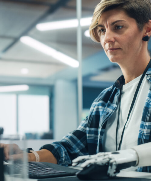 Diverse Body Positive Office: Portrait of Motivated Woman with Disability Using Prosthetic Arm to Work on Computer. Beautiful Professional with Thought Controlled Body Powered Myoelectric Bionic Hand