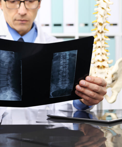 Radiologist doctor checking xray, healthcare, medical and radiology concept