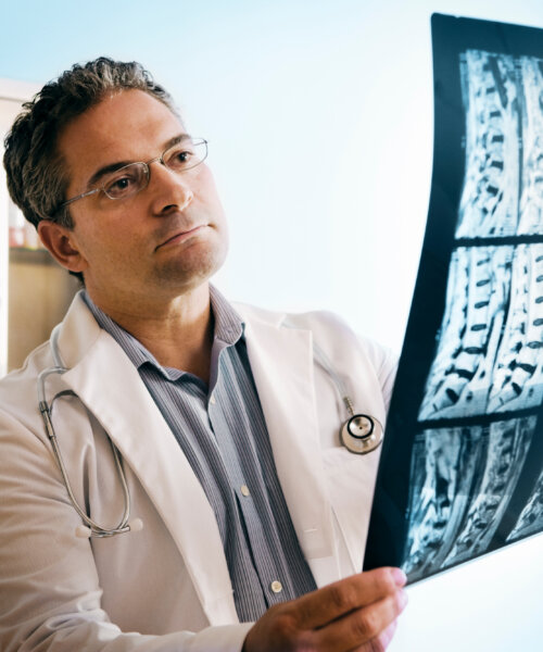 Doctor looking at MRI of spinal cord.