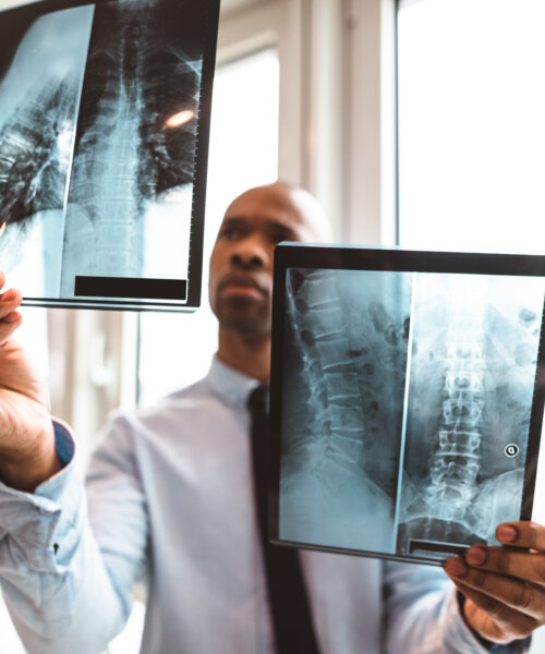 doctor reading the x-ray in the office